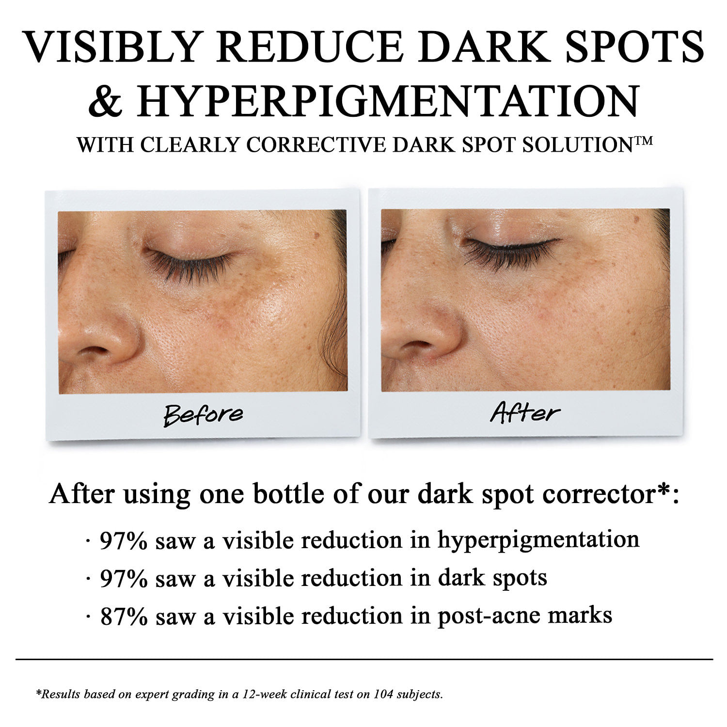 Dark Spots Vanish: Way of Will Brightening Serum Works!
