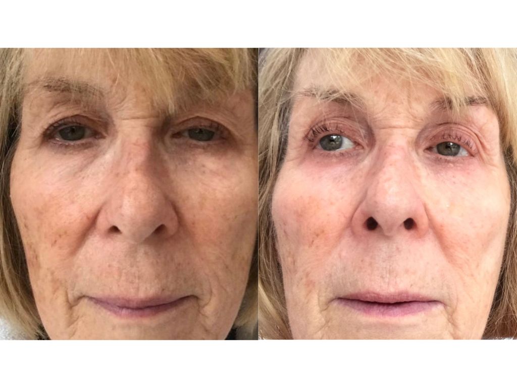 Serum La Prairie Skin Caviar: Instant Lift Results!