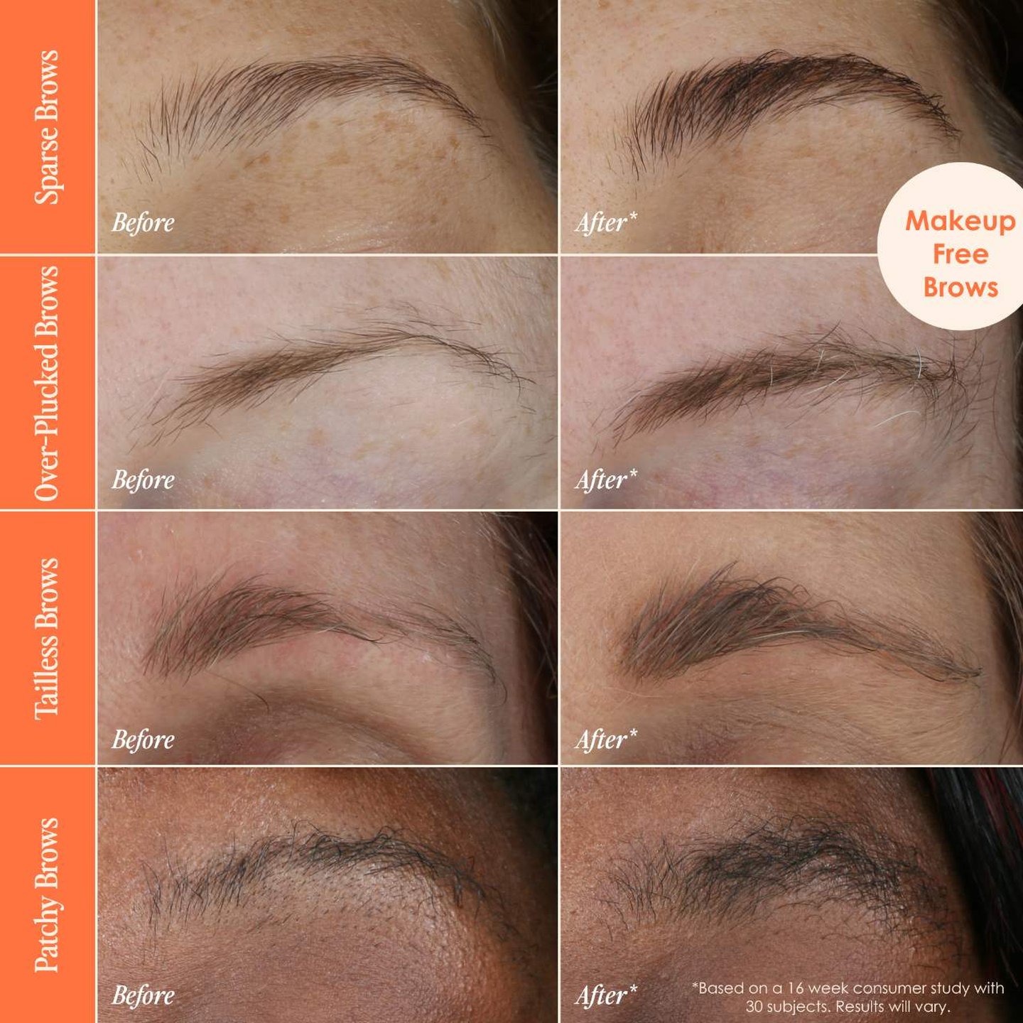 Claire Serum Review: Before & After Results Will Shock You