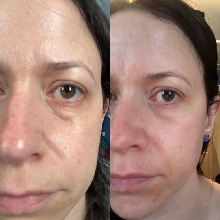 Claire Serum Review: Before & After Results Will Shock You