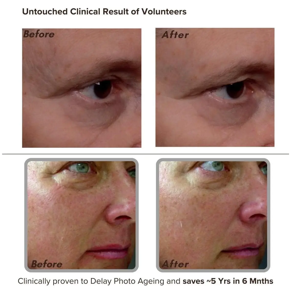 Youthology Serum Before & After: Shocking Results