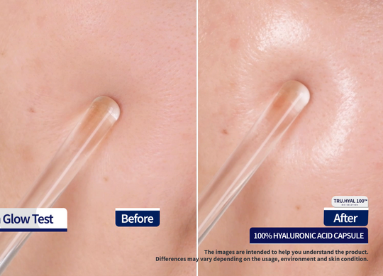 30-Day Before and After Hyaluronic Acid Serum Test