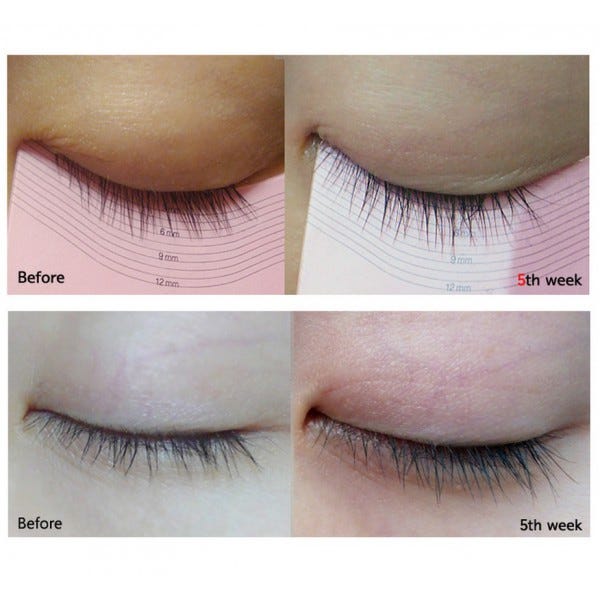 Best Korean Eye Lash Serum 2025: See Results in 4 Weeks!