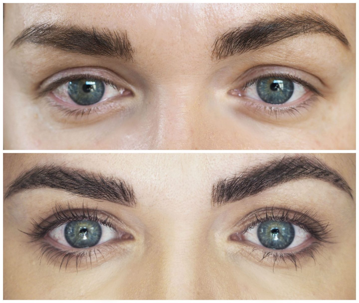 Get 45% More Lashes! Advanced Eyelash Growth Serum Results