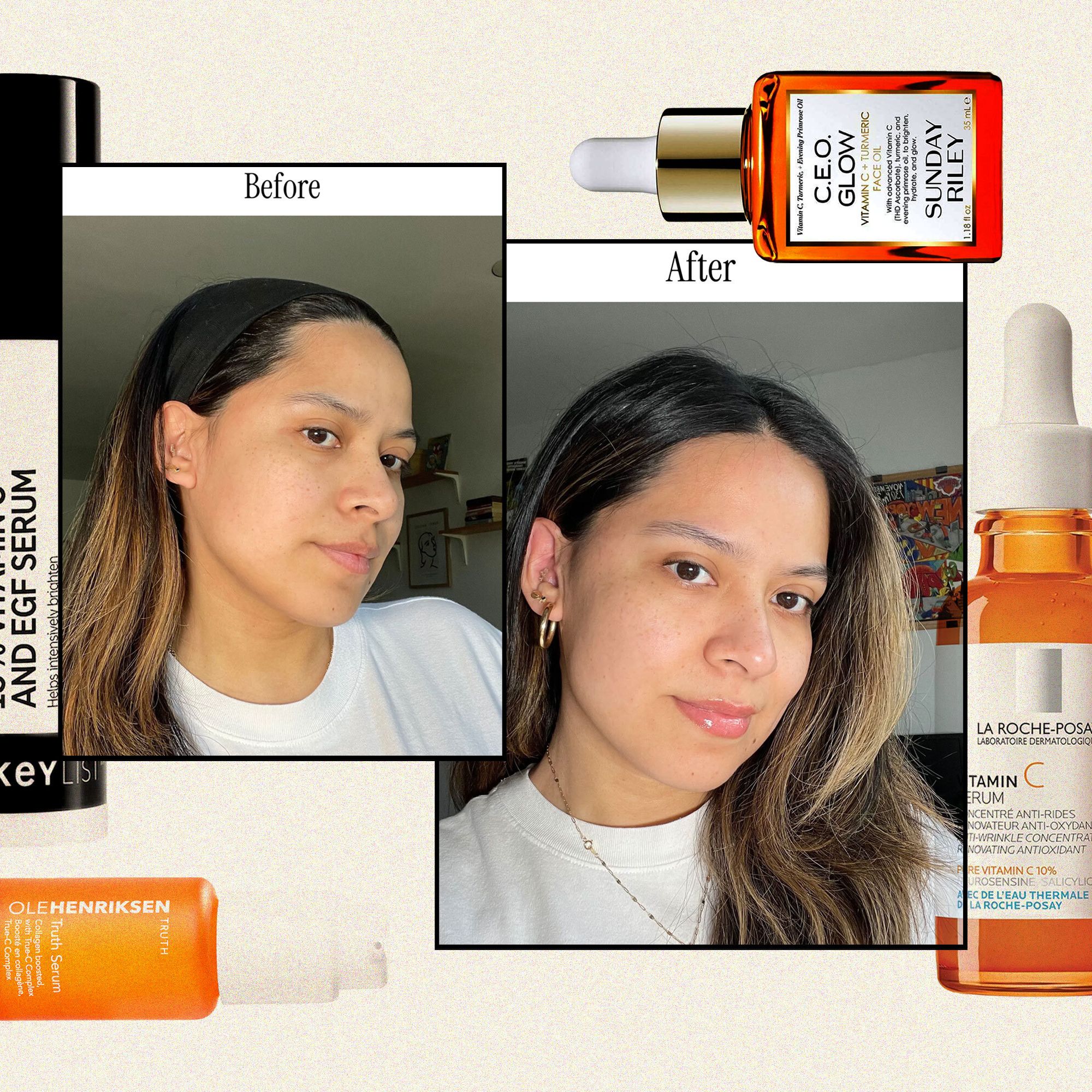 Serum vs Cream: Which Vitamin C Actually Works?