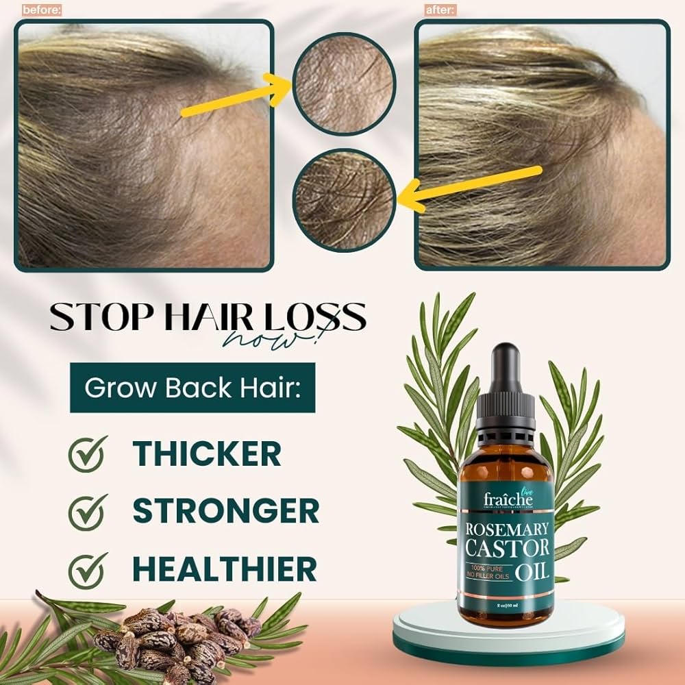Stop Hair Loss: Castor Oil Serum for Hair Growth Results