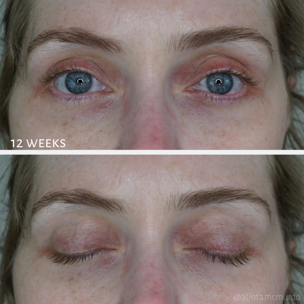 Cangro Eyelash Serum Results: Before & After Photos 2025