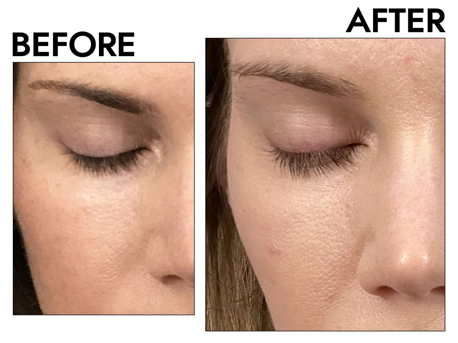 Does Lash Growth Serum Work? 2025 Dermatologist Says