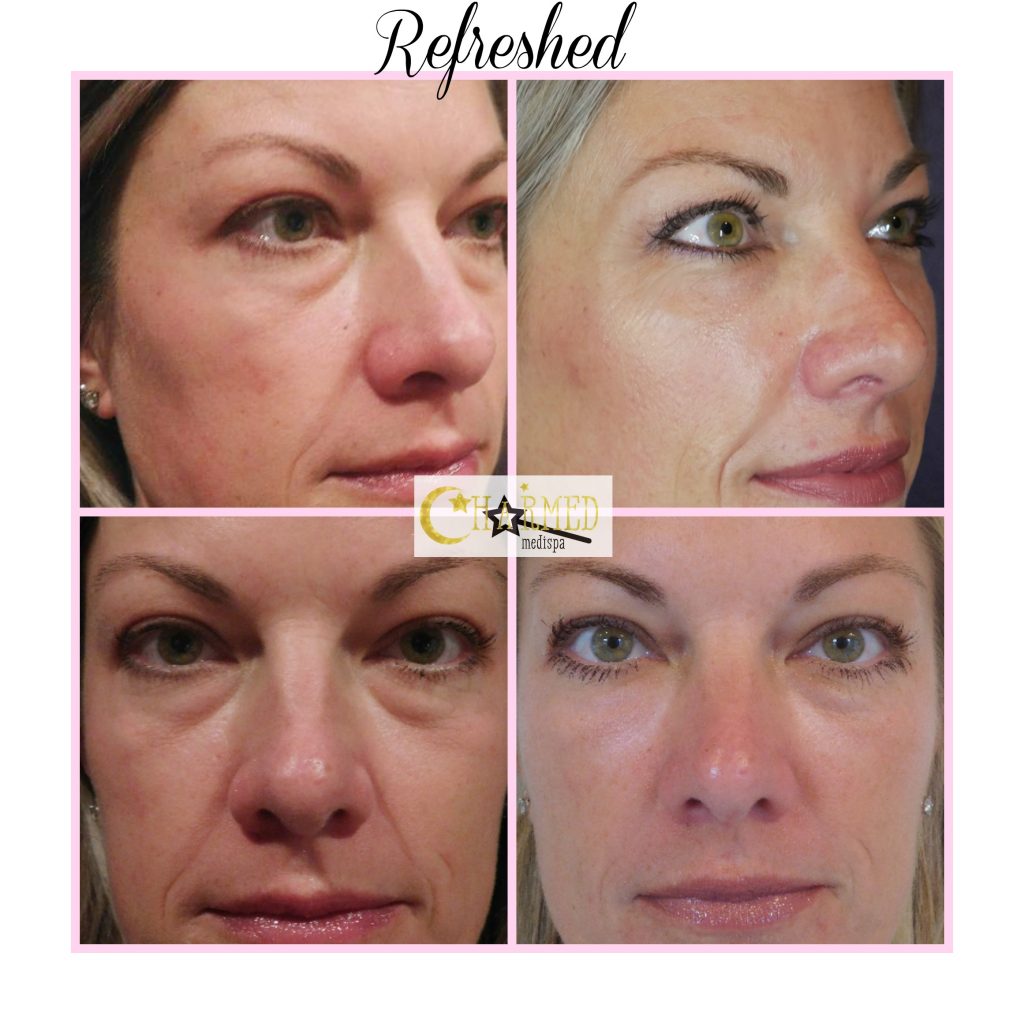 Youthology Serum Before & After: Shocking Results