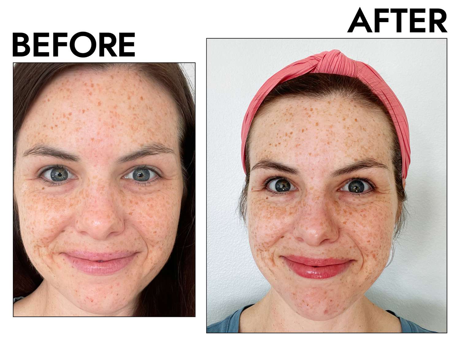 Best Illuminating Serum Face - Get Glowing Skin in 2 Weeks