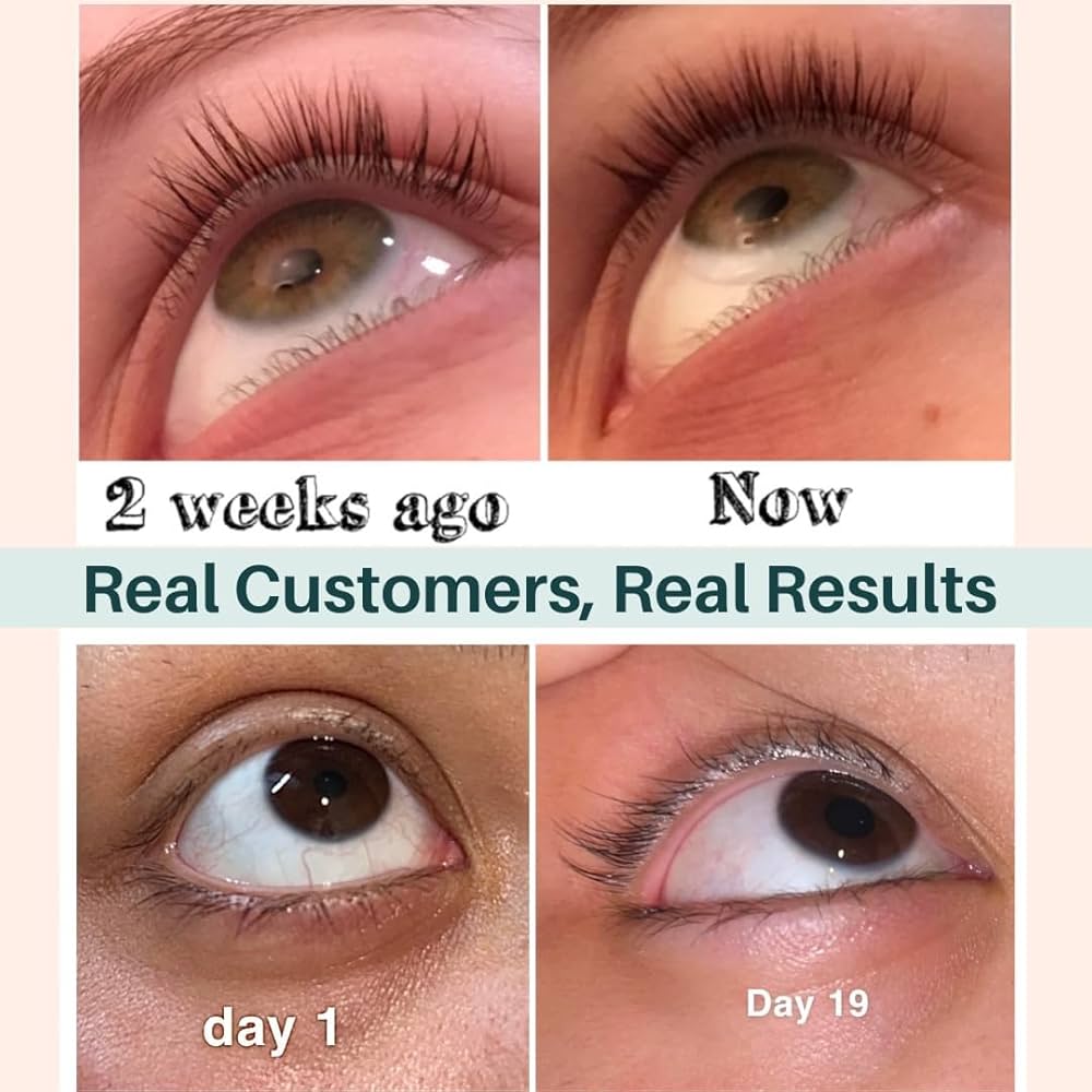 Eyelash Growth Serum Castor Oil: See Results in 2 Weeks!