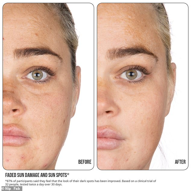 Dark Spots Fade: Vitamin C Serum Before and After Glow