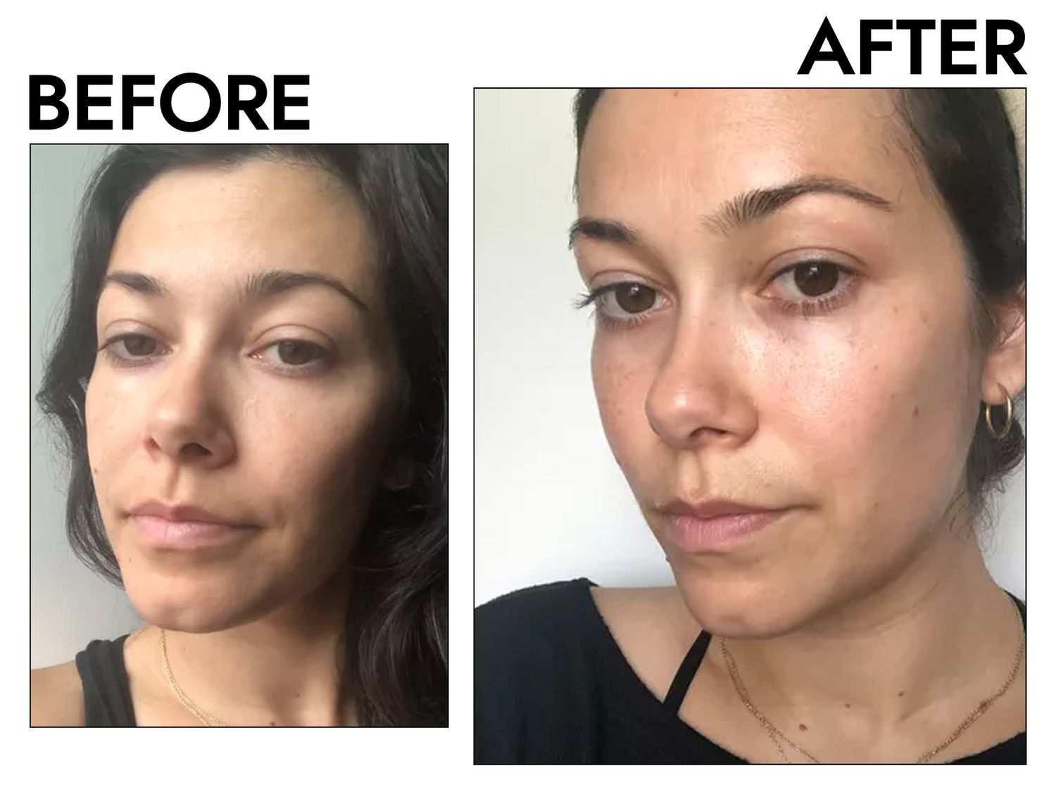 Transform Your Skin Fast - Dr Serum Before & After