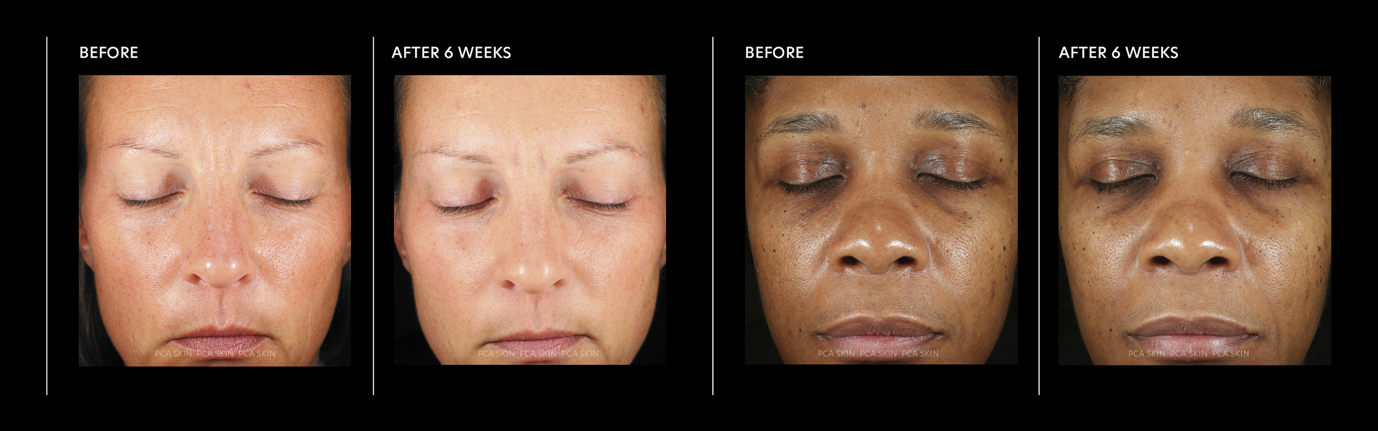 Youthology Serum Before & After: Shocking Results