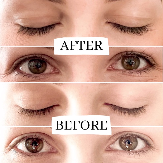 Real Users Share Borboleta Lash Serum Reviews + Before After