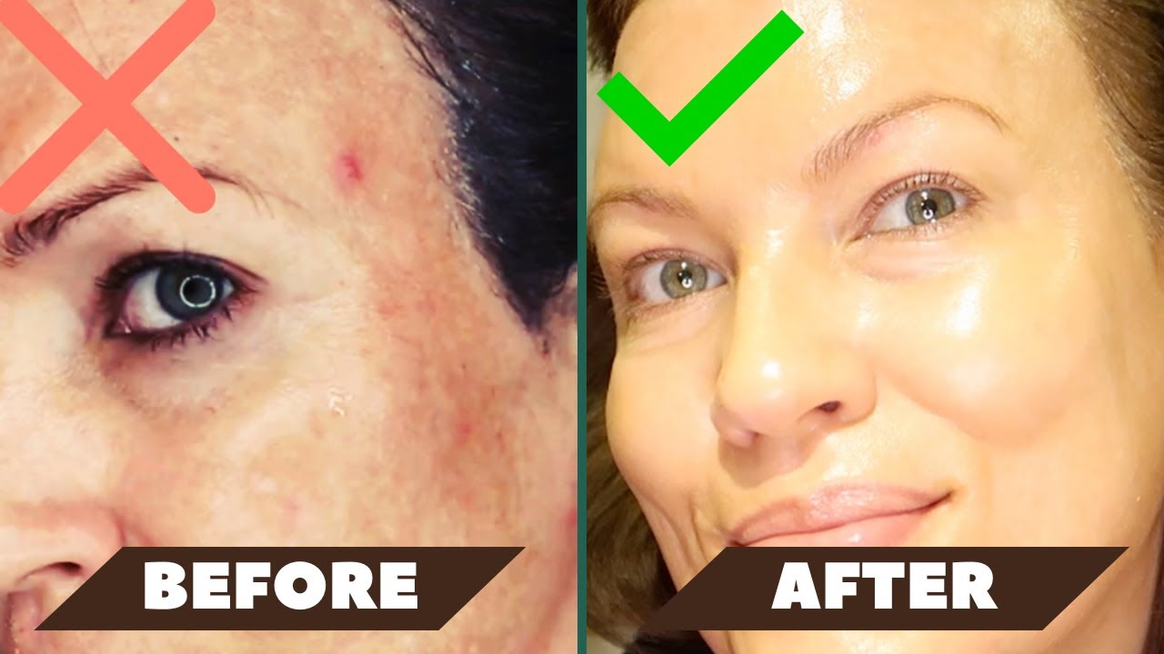 Dark Spots Fade Fast with Dermatologist Asta C Serum